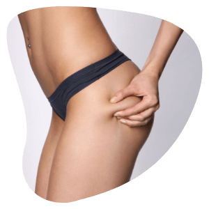 Copy of Untitled (4) (1)