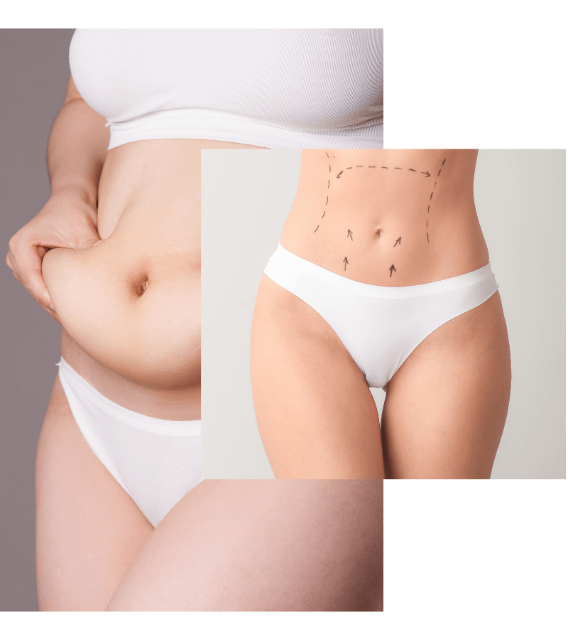 Untitled design (51) (1)