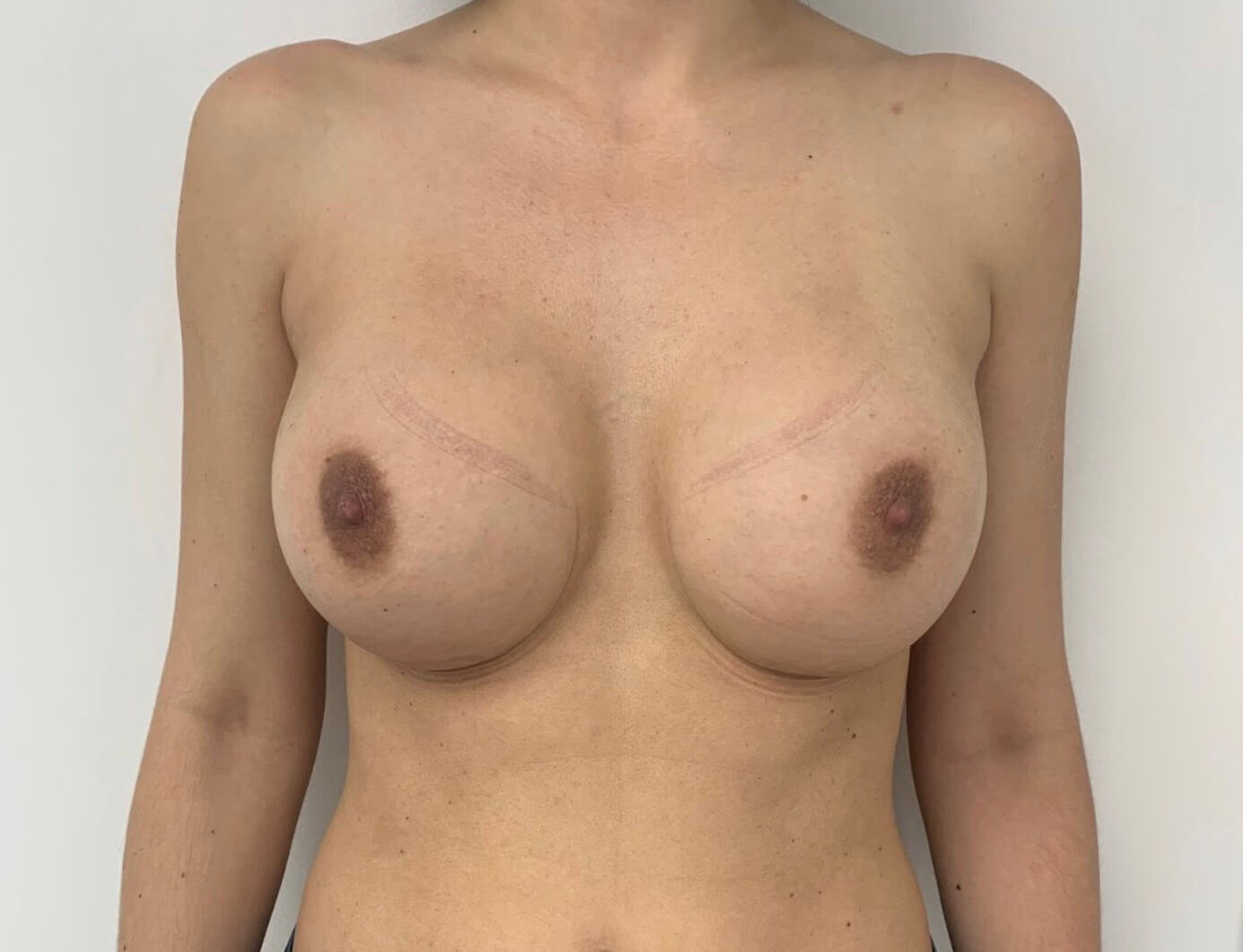 3515C60B-9865-47BE-9B41-7D3DB9B97D33