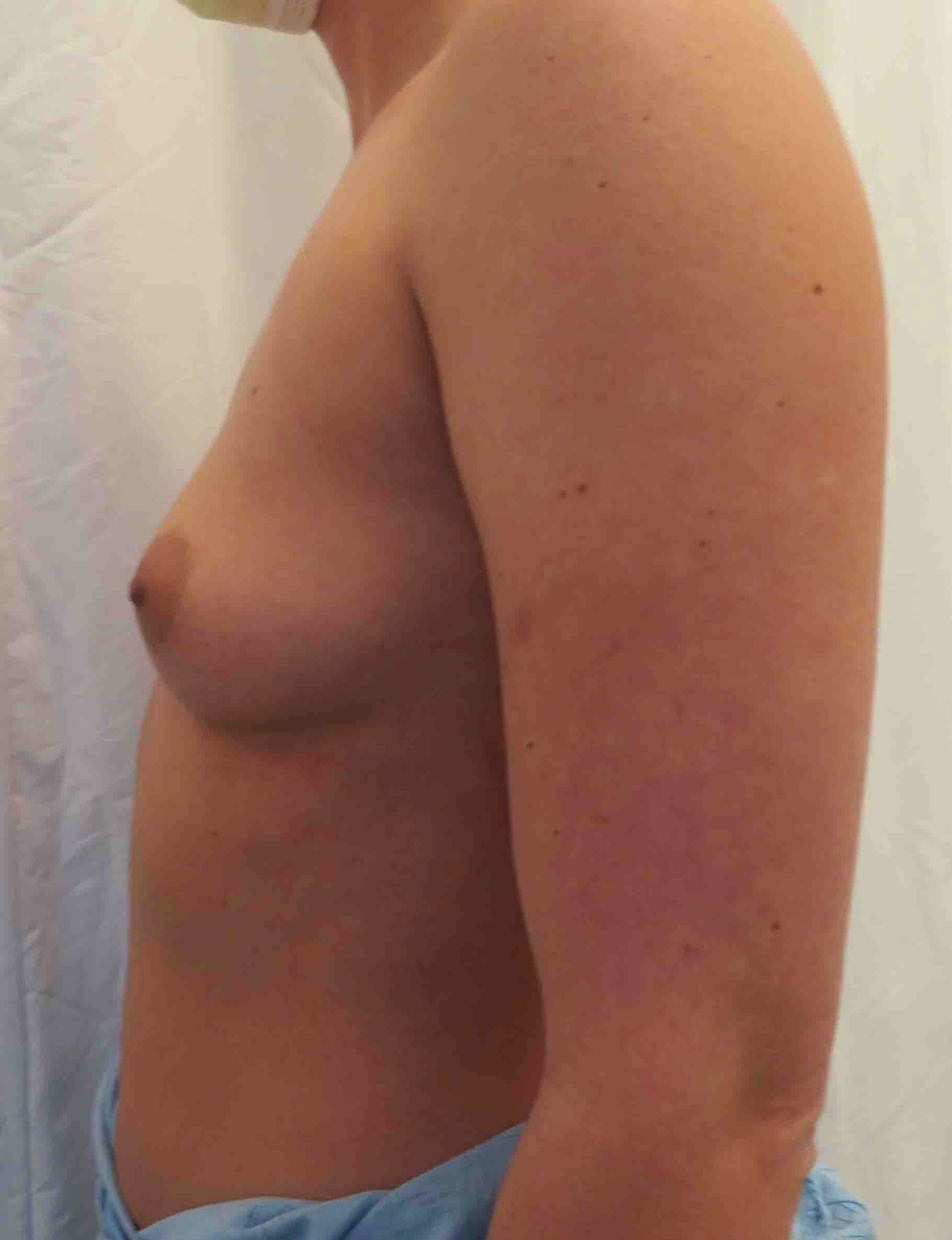 Patient356b copy (1)