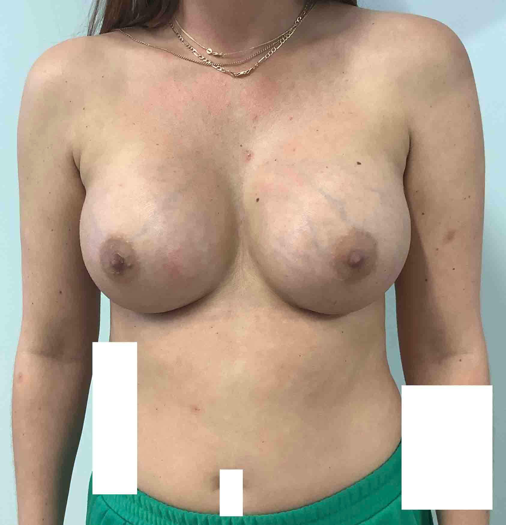 pateitn356_1_after (1)