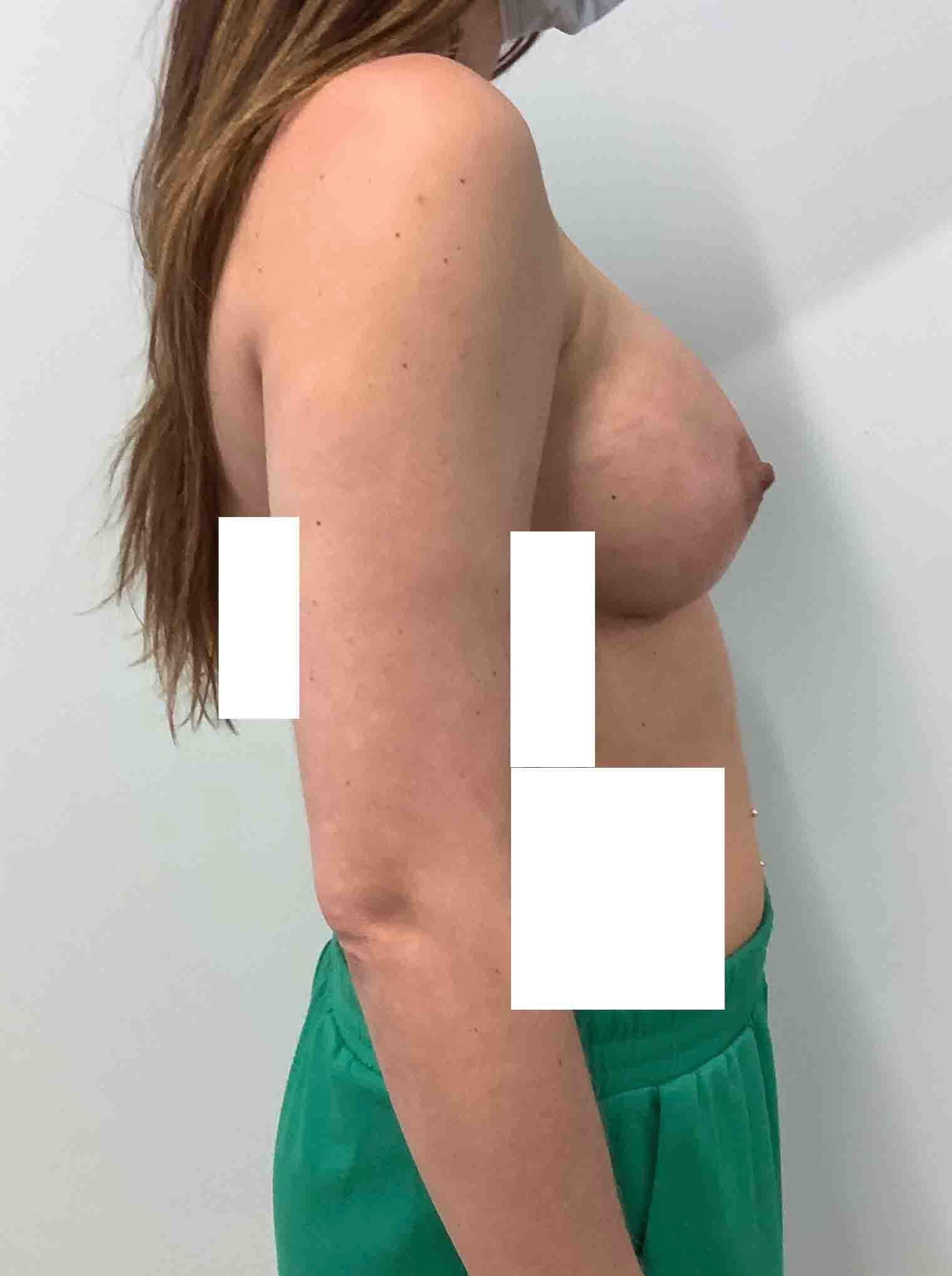 patient356b_2_after (1)